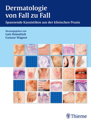cover image of Dermatologie von Fall zu Fall